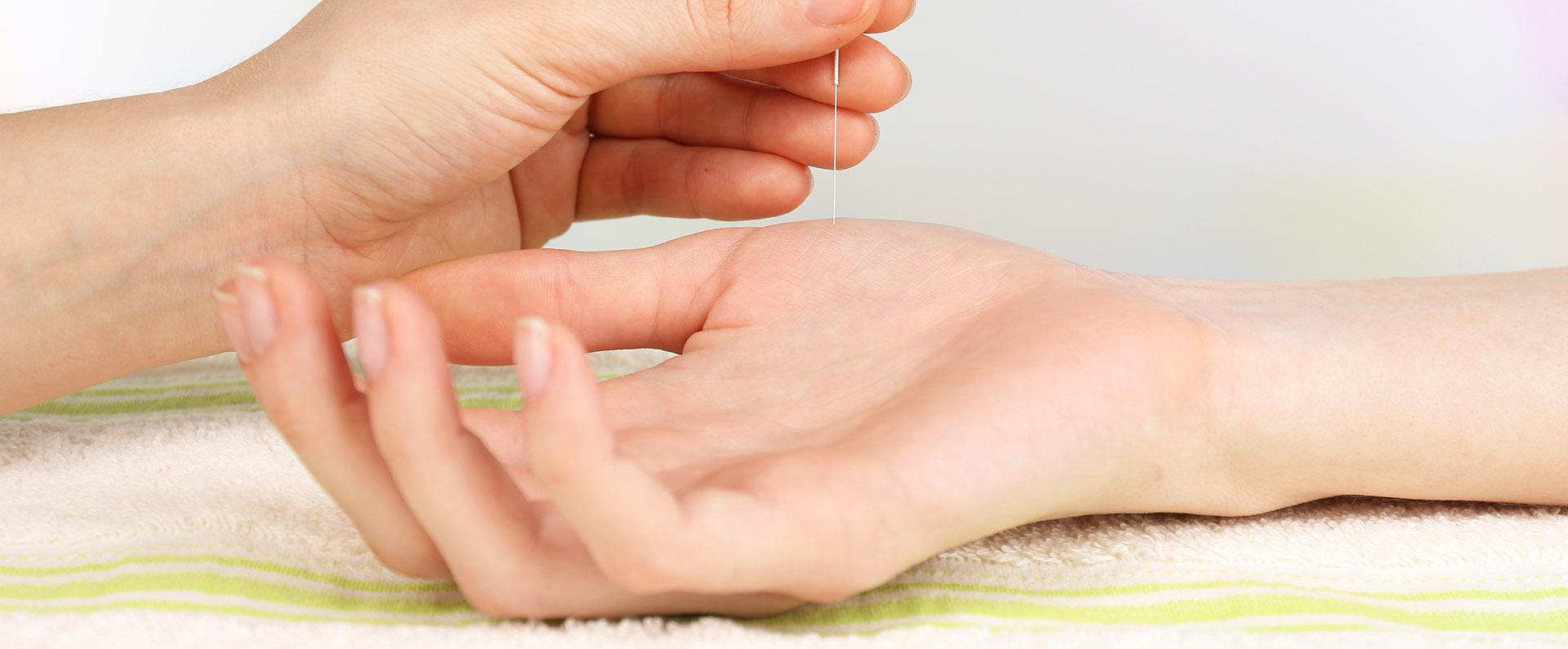 agopuntura stock image 43075321 acupuncture on hand close up topbig